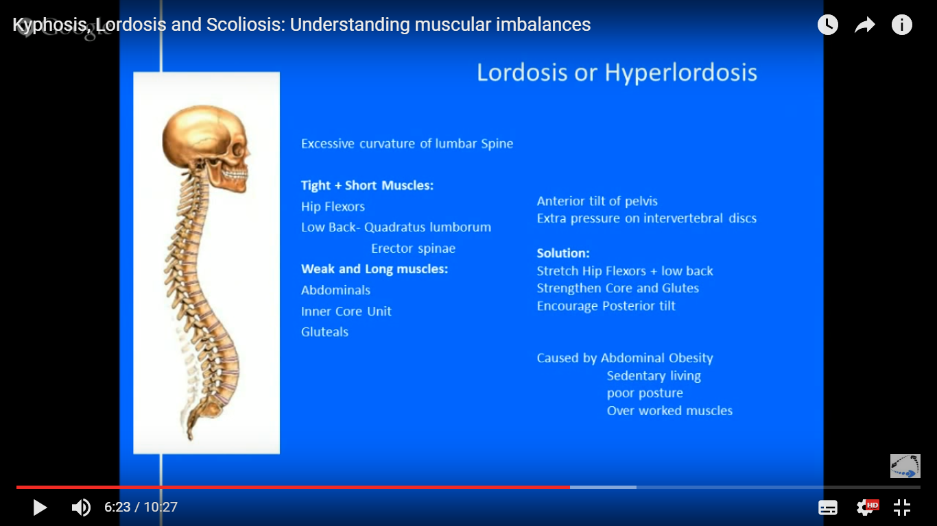 understanding muscular imbalances kyphosis, scoliosis, lordosis