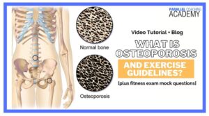 What Is Osteoporosis and Exercise Guidelines?